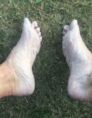 CC Breckland 12hr time trial: wrinkled feet
